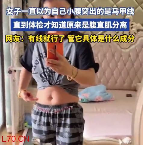 女子的“马甲线”原来是腹直肌分离